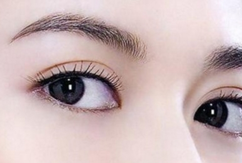 杭州比較好的割雙眼皮醫(yī)生排行榜更新丨手術(shù)費(fèi)用詳解