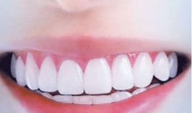 呢？衢州美萊整形美容醫(yī)院簡介、技術(shù)優(yōu)勢(shì)、口碑在線查看！