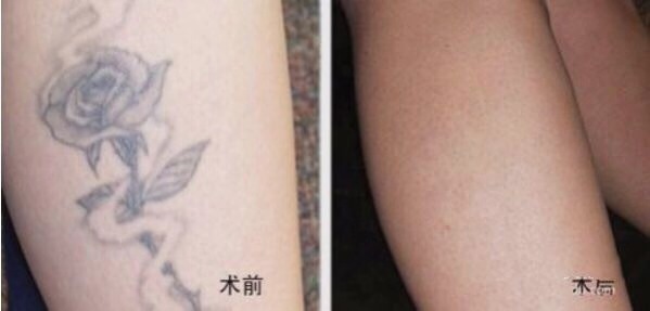 不二選擇！上海鼻修復(fù)專家徐永豐、劉仁輝搶占熱門名單成功！個人實力攀升不可阻擋！