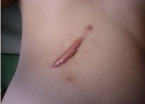 南寧激光美容中心哪家好？探索最佳的南寧激光美容中心排名及用戶口碑