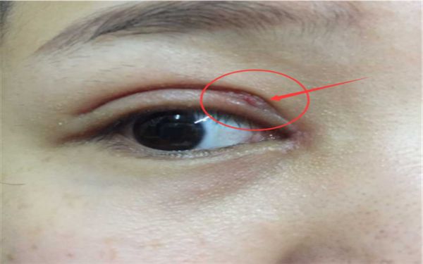 蘇州隆胸哪家醫(yī)院好？專業(yè)醫(yī)師為您分析