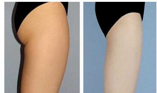 烏魯木齊超聲刀哪家好？烏魯木齊超聲刀醫(yī)院排名及專家推薦