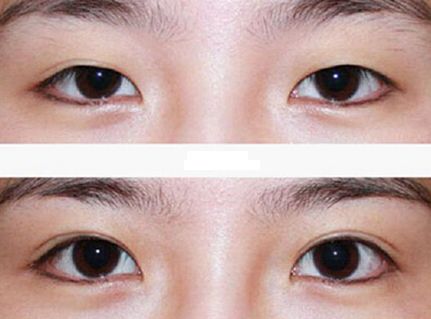 廣州整容鼻子技術(shù)排名前列的醫(yī)院有哪些？