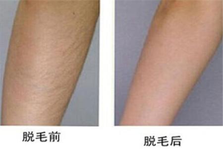 2023上海面部疤痕凹陷修復(fù)醫(yī)生前十榜單(葉賽春、吳淑琴、李春新榜首屬實(shí)意外)