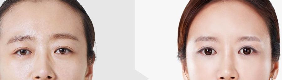 昆明祛疤醫(yī)院哪家好，正規(guī)機(jī)構(gòu)推薦