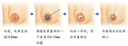 在哈爾濱做除皺哪家醫(yī)院好？選擇專業(yè)除皺醫(yī)生，享受高質(zhì)量護理服務(wù)