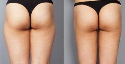 深圳面部填充醫(yī)院排名與選擇，哪家好？