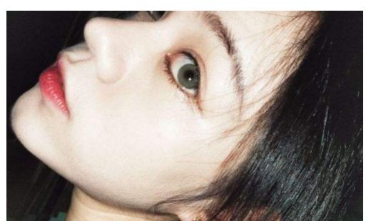 找一家靠譜的汕頭去除疤痕醫(yī)院？看這里！