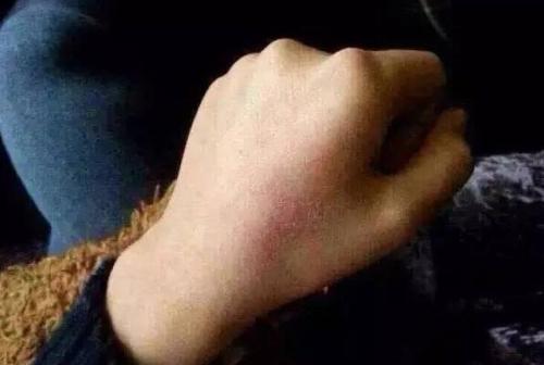 2023德陽去除頸部皺紋皺紋醫(yī)生榜單top10強(qiáng)(孫正宇、陳莉、馮光殺出重圍)