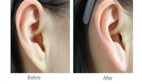 如何選擇西安哪家醫(yī)院術(shù)后康復(fù)好的機(jī)構(gòu)？