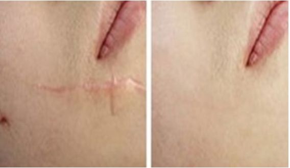 成都整容醫(yī)院哪家更專業(yè)靠譜？哪家整容醫(yī)院口碑好？