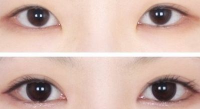 西安王者風(fēng)范嫩膚哪家好？一文讀懂西安嫩膚機構(gòu)排行榜