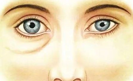 酒糟鼻南寧哪家醫(yī)院好？專家推薦南寧哪家醫(yī)院治療酒糟鼻效果最好