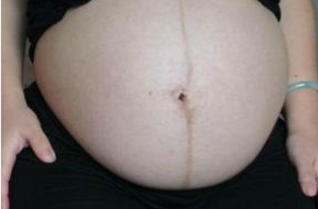 上海哪里有鼻修復(fù)專家？選擇困難癥仙女來(lái)了，點(diǎn)擊查看醫(yī)生介紹和價(jià)格！