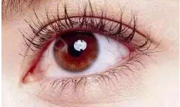 揚州華美整形高軍飛：體驗韓式祛眼袋的神奇效果