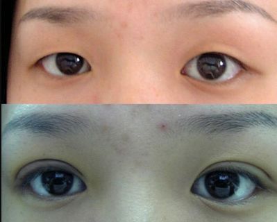 唐山哪家鼻子整形醫(yī)院好？權(quán)威專家為您解答