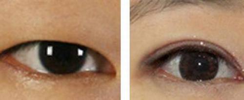 2023廈門去眼周紋手術(shù)評(píng)分前十名醫(yī)生(賈赤宇、崔英煥、顏金輝上榜)