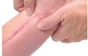 廣州哪家美容醫(yī)院好？詳細(xì)比較廣州頂級(jí)醫(yī)療機(jī)構(gòu)個(gè)美容醫(yī)院的優(yōu)缺點(diǎn)