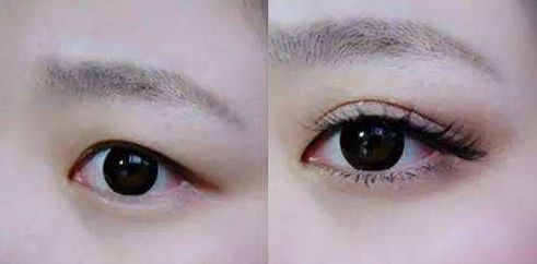 天津祛痘醫(yī)院哪家好？解決痘痘問題，選擇最佳去痘醫(yī)院