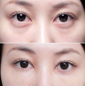 杭州厚唇變薄醫(yī)院哪家好？