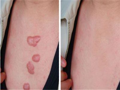 云南哪家整形醫(yī)院好？找個專業(yè)的才放心！