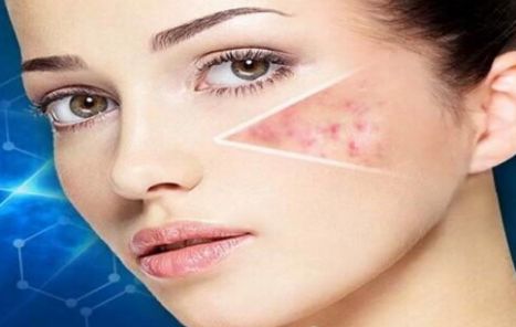 昆明祛痘效果最好的美容醫(yī)院推薦！