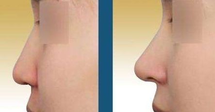 西安哪家皮膚美容機構(gòu)做得好？