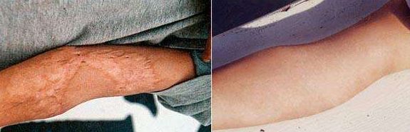 北京下顎骨手術(shù)哪家好？全面解析北京市優(yōu)質(zhì)下顎骨手術(shù)醫(yī)院及醫(yī)生推薦