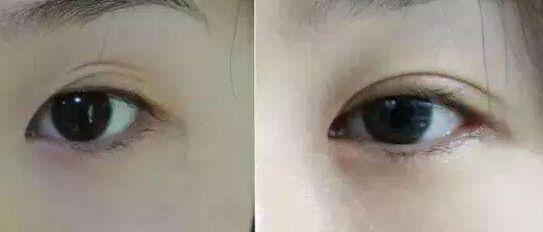 南京哪家假體豐胸醫(yī)院好？醫(yī)術(shù)精湛、效果明顯的南京豐胸?？漆t(yī)院推薦