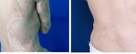 上海隆鼻哪家整形醫(yī)院好？權(quán)威醫(yī)生為您推薦的上海隆鼻醫(yī)院排行榜