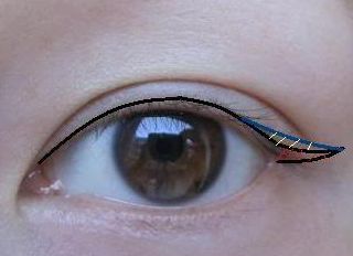 2023昆明隆胸整形哪家醫(yī)院好？專家推薦與真實案例一覽