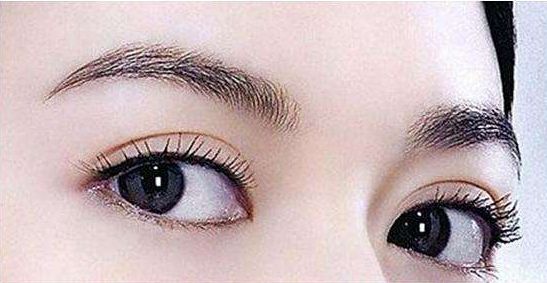 哪家成都醫(yī)院最適合取肉痣？專業(yè)醫(yī)療機(jī)構(gòu)推薦