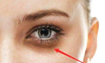 學(xué)會提升面部凹陷吧！病例分享，術(shù)后30天的終極效果。