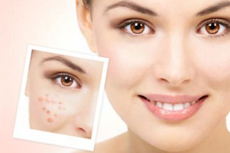 蘇州治療痘痘最好的醫(yī)院有哪些？