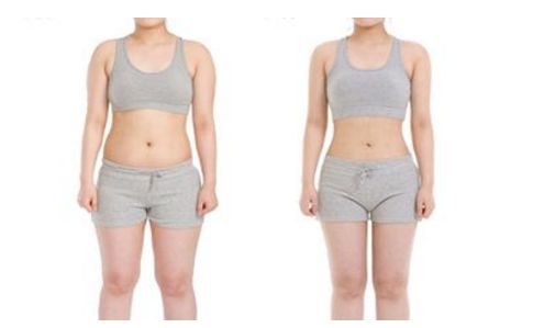 上海哪家醫(yī)院能有效去除妊娠紋，讓肌膚重新恢復(fù)緊致？