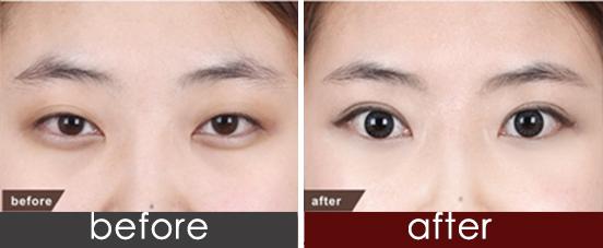 2023菏澤”蝶弧”水韻豐胸術(shù)專家前10位口碑榜(白立明、任偉、李超人氣top榜推薦)