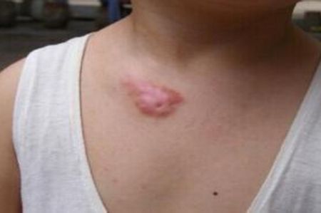 上海切眼袋手術(shù)醫(yī)院排名及口碑如何？