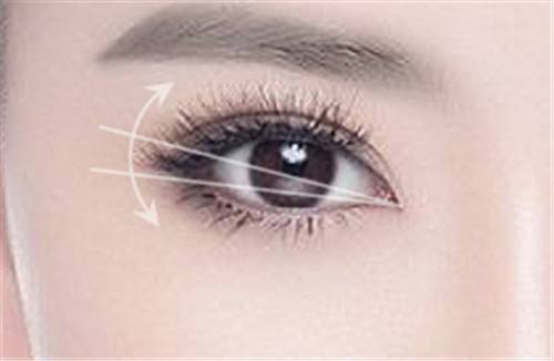 郭勇醫(yī)生的坐診地點及發(fā)際線種植案例，完美解決“禿頭少女”之困