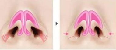 荊州美傲整形醫(yī)院門診有哪些擅長的項目？