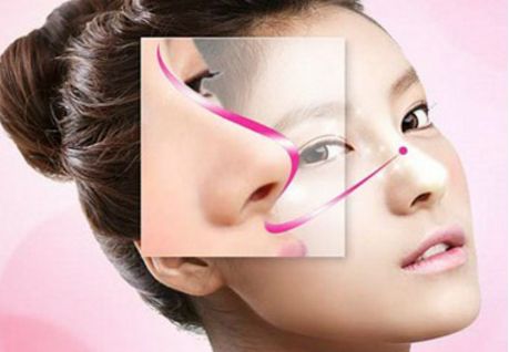 深圳駝峰鼻矯正哪家好？專業(yè)醫(yī)生推薦與真實(shí)案例分享！