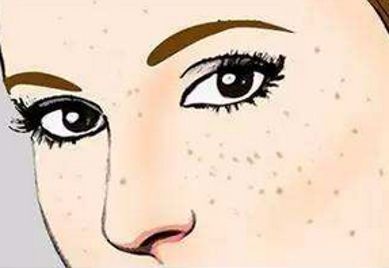 上海范榮杰醫(yī)生鼻部整形案例詳解，效果如何？