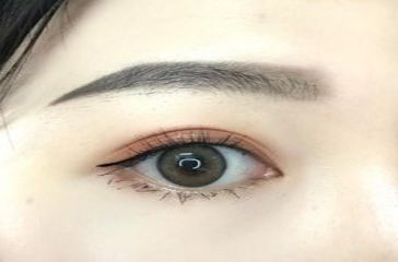 上海去黑眼圈哪個醫(yī)院好？專家推薦的實力醫(yī)院排行榜