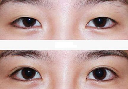 北京哪家激光祛痘醫(yī)院好？選擇正規(guī)醫(yī)療機構(gòu)，實力專家團隊等你來解答