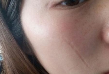 濟(jì)南哪家醫(yī)院做豐胸效果好？排名靠前，技術(shù)專業(yè)的有哪些？