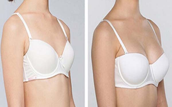 2023黑龍江3D精微祛眼袋在榜名單前10位專家(魯文起、尹又階、李麗麗個(gè)個(gè)醫(yī)生人氣高)