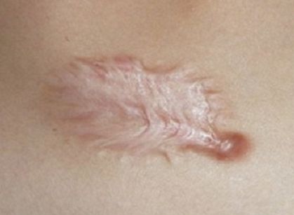 海南去雀斑哪家醫(yī)院好？探尋海南最受歡迎的雀斑祛除醫(yī)療機(jī)構(gòu)