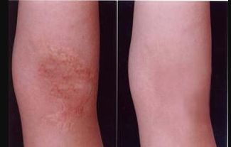 煙臺雙眼皮醫(yī)院哪家好？選專業(yè)技術(shù)高超、口碑好的醫(yī)院推薦