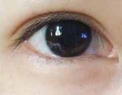 蘇州哪家祛痘醫(yī)院好？專家推薦的治療痘痘效果好的醫(yī)院