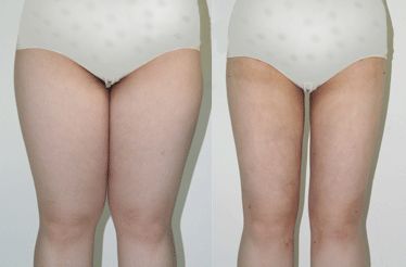 南京雀斑祛除十強(qiáng)診所：專業(yè)技術(shù)，效果顯著