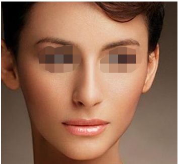 隆鼻失敗想要修復？可以嘗試硅膠假體修復方法!